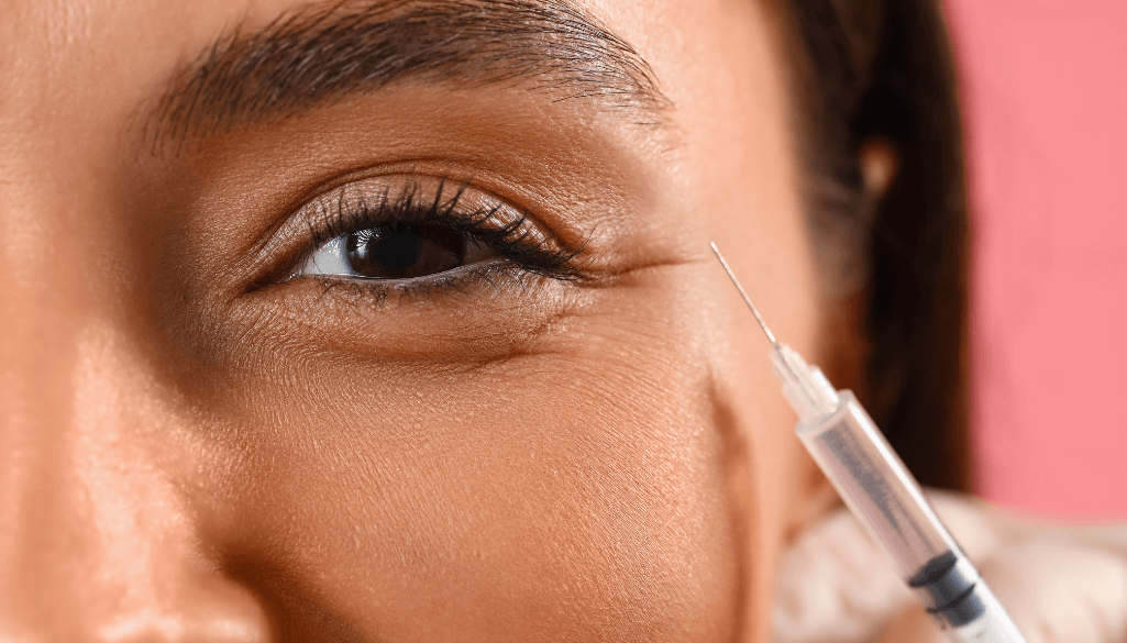 Tear Trough Filler