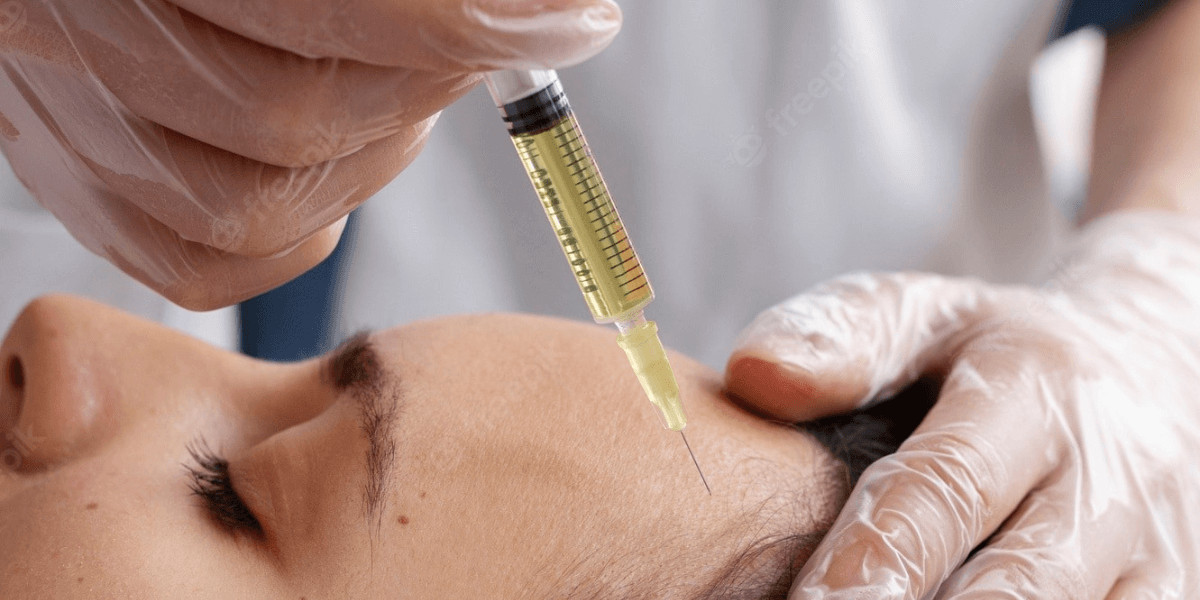 PRP - Platelet Rich Plasma