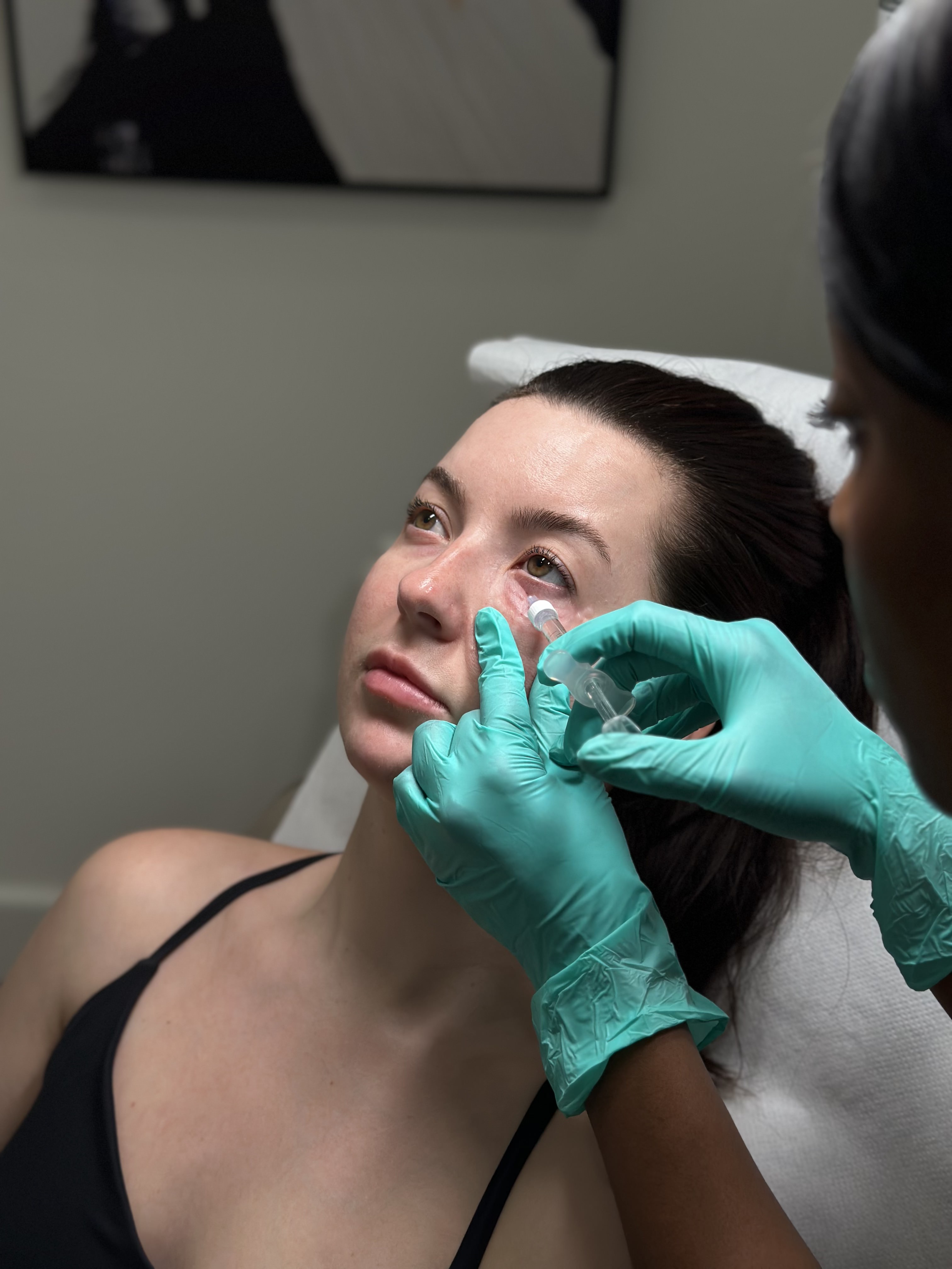 Skin Boosters